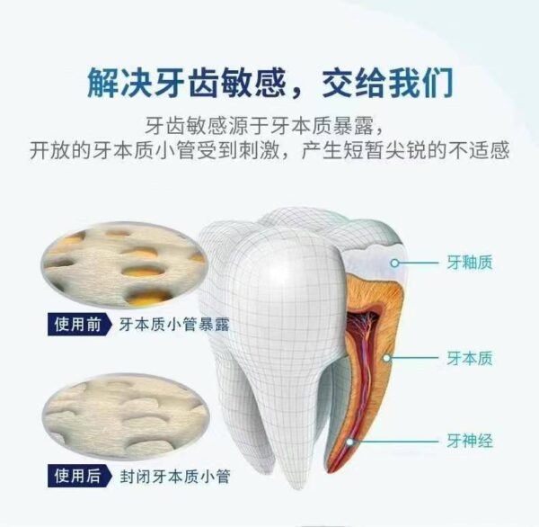 Sensodyne舒适达美白抗敏牙膏4支家庭装 - 图片 4