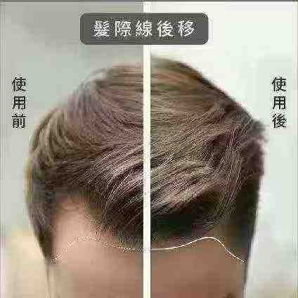 来自亚马逊土著的神秘配方Lavisherb生发精华200ml - 图片 8