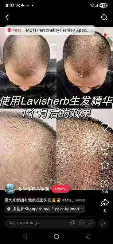 来自亚马逊土著的神秘配方Lavisherb生发精华200ml - 图片 10